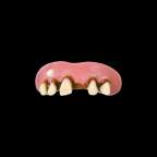 prosthetic teeth and fangs